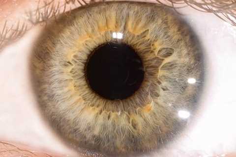 Life after death for human eye: Scientists revive light-sensing cells in organ donor eyes