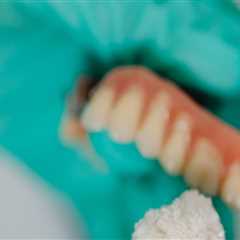 Dentistry In London: The Importance Of Wearing Personal Protective Equipment During Dental..
