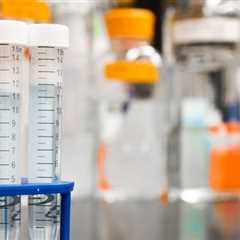 A Guide to the Benefits of a Lab Information System (LIS)