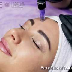 Amazing Benefits of Microneedling for Your Face - B.A.R.E SPA